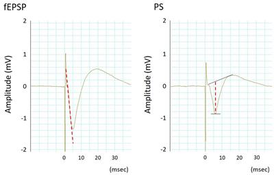Sepsis-induced modulation of long-term potentiation induced by theta burst stimulation in the rat hippocampus